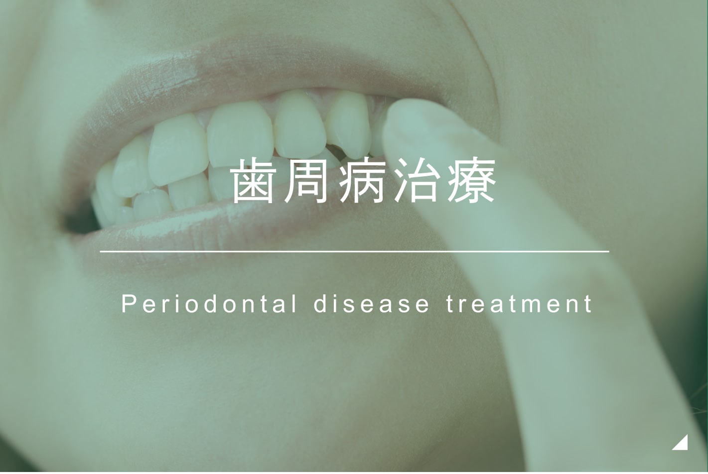 歯周病治療