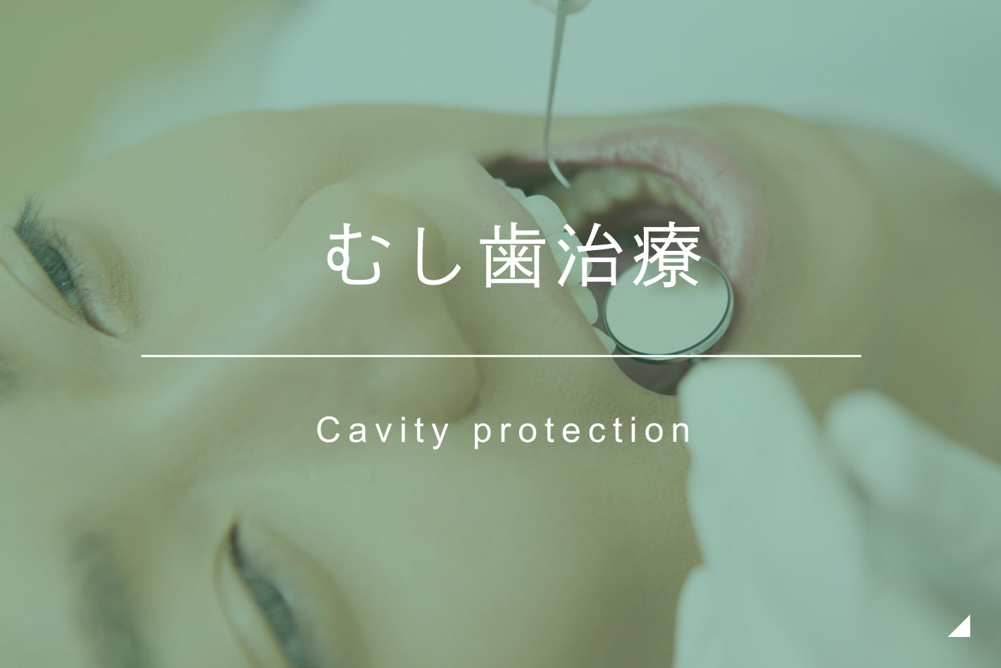 むし歯治療