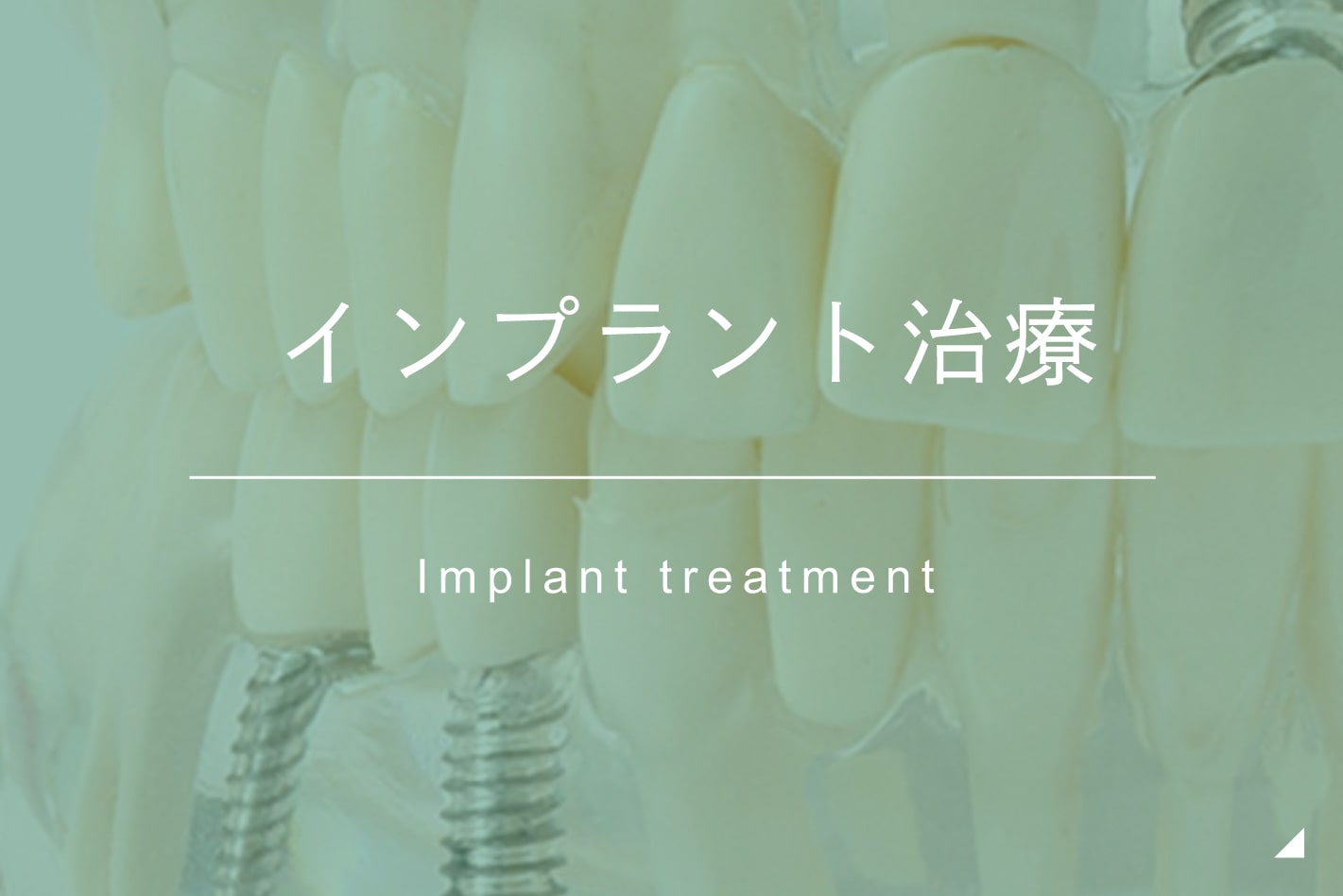 インプラント治療